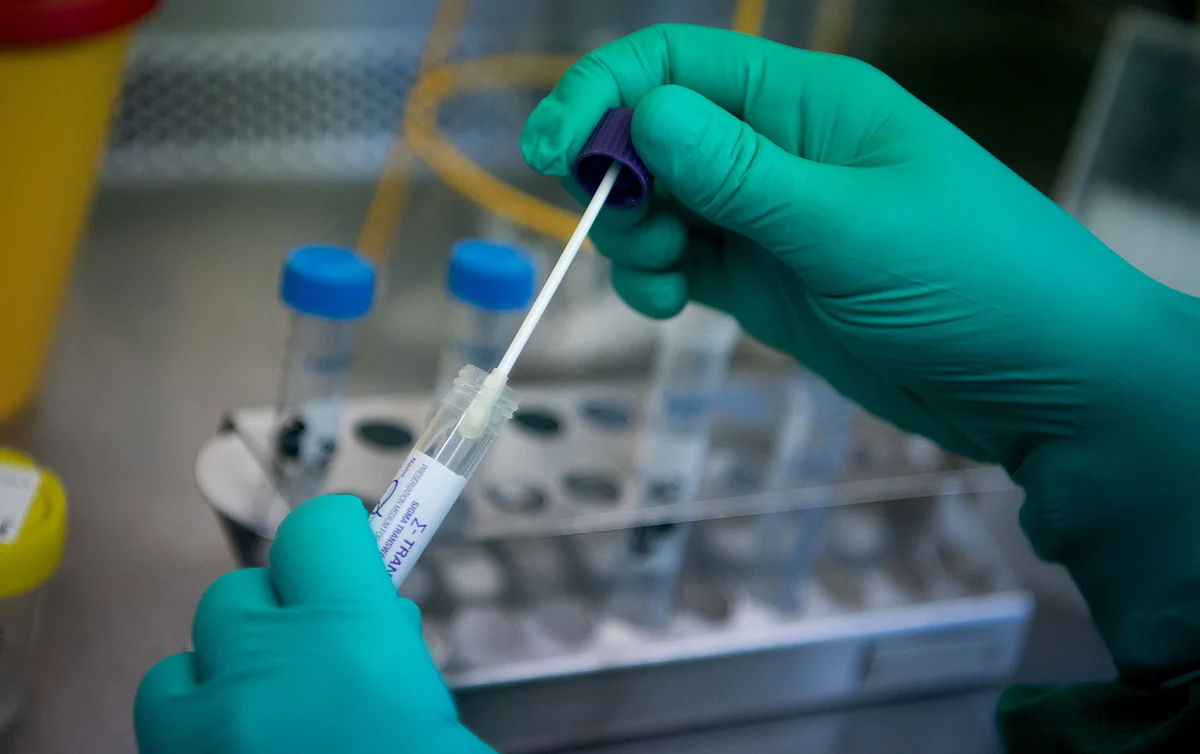 Plea moved before Supreme Court to ensure cost-free COVID-19 testing facility for all
