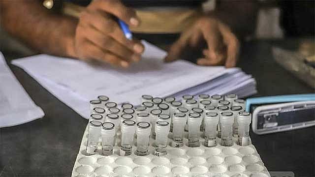Bangladesh reports 14 new COVID cases in a day with no deaths - Vimarsana News