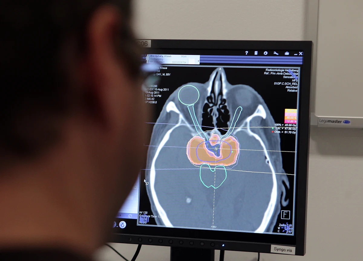 Simple Eye Test May Help Diagnose Alzheimer’s Disease