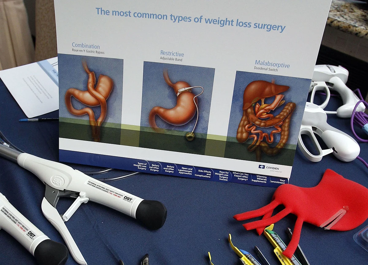 For Diabetics, Weight-Loss Surgery Slashes the Risk of Death