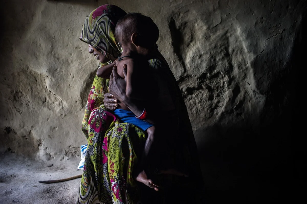 A woman poses for a photograph with her malnourished child in the village of Paltupur, Uttar Pradesh, India. (Photographer: Sanjit Das/Bloomberg)