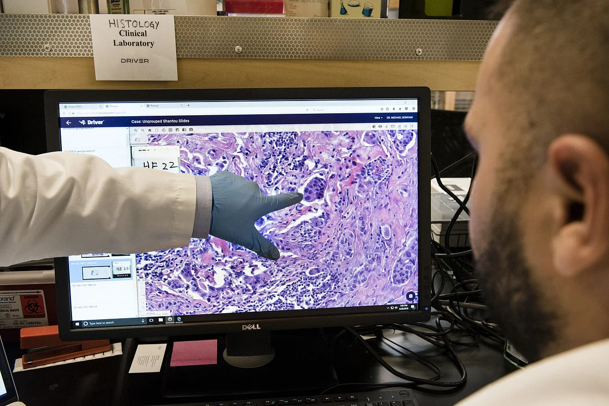 U.S. Cancer Death Rates Are Dropping at the Fastest Pace on Record