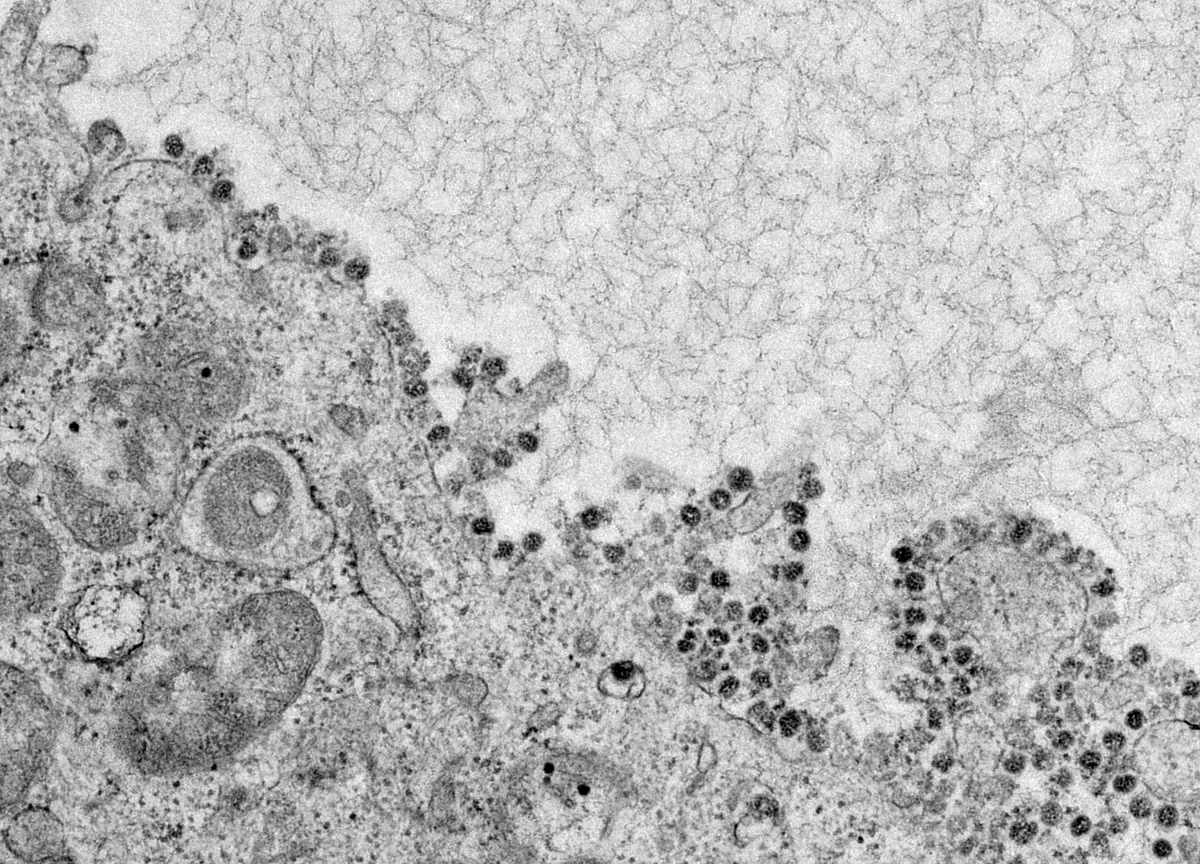 Coronavirus Lurking in Feces May Reveal Hidden Risk of Spread