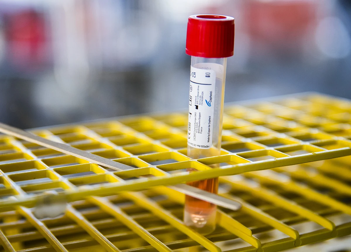 U.S. Labs Face Crisis After Crisis Despite Improvements in Testing