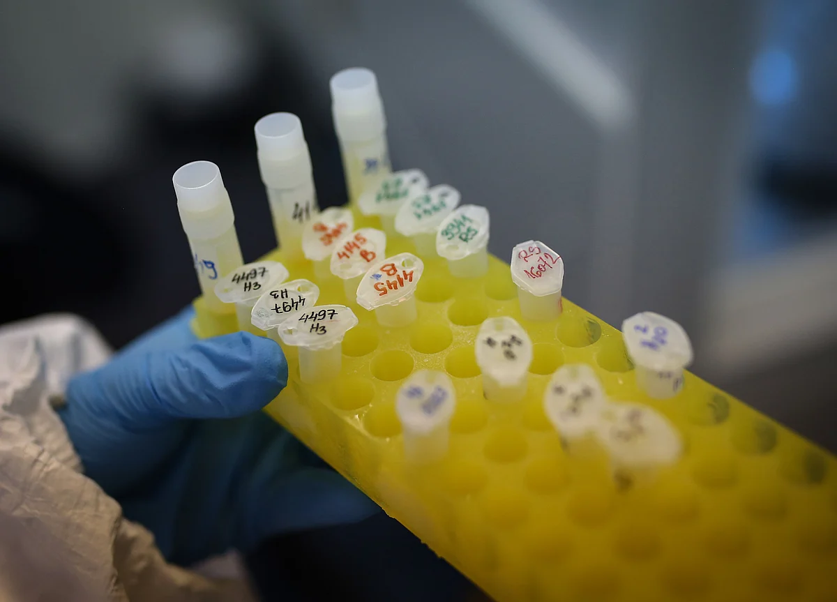 Virus Vaccine May Be Ready for Mass Production By Autumn, Oxford Professor Says