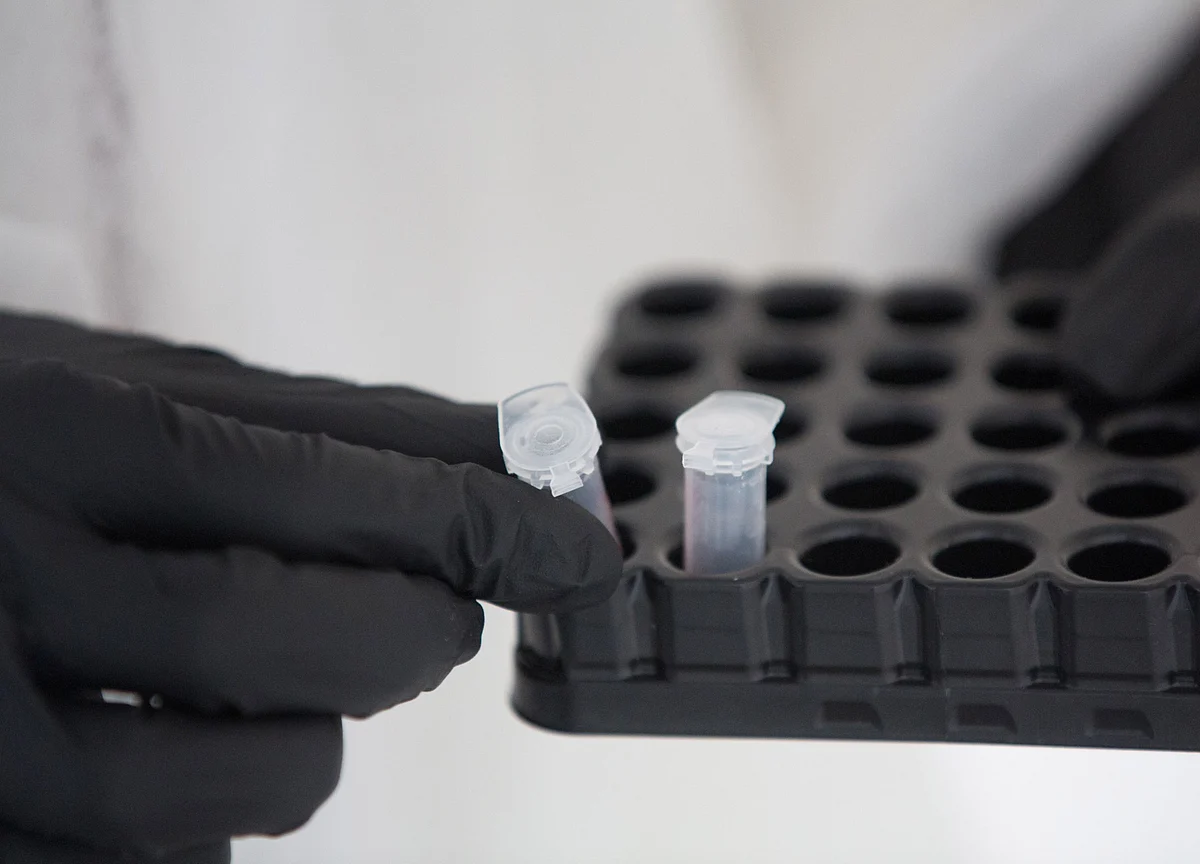 Dead Coronavirus Particles Muddy the Outcome of Test Results