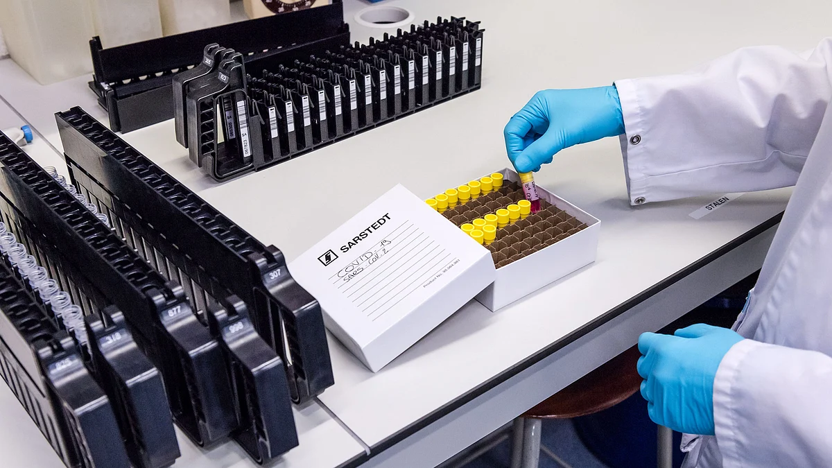 A laboratory worker removes a patient’s sample test tube during coronavirus detection tests in the virology research labs at UZ Leuven university hospital in Leuven, Belgium. (Photographer: Geert Vanden Wijngaert/Bloomberg)