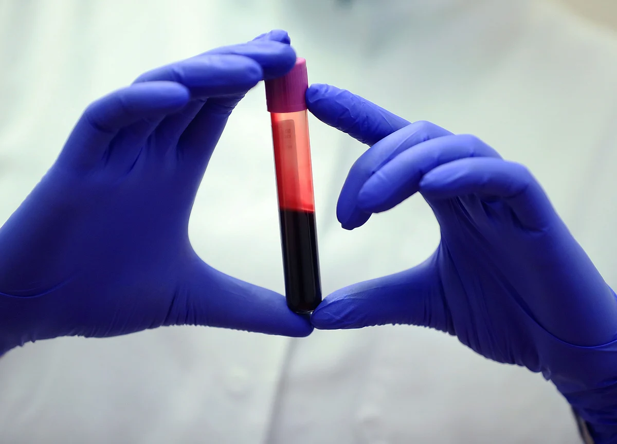 I Had to Take Five Antibody Tests to Get Results I Could Believe