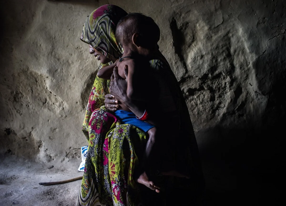 More Than a Third of Earth’s Population Faces Malnutrition Due to Covid