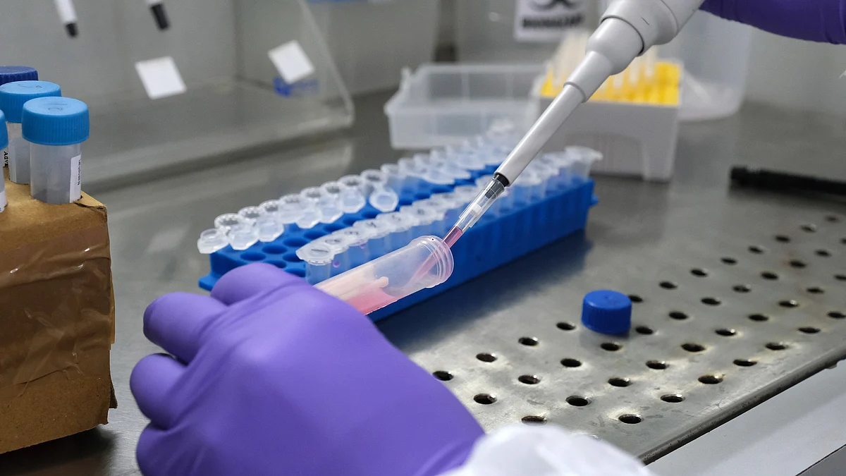 <div class="paragraphs"><p>A technician uses a single channel pipette dropper for RNA Extraction during Covid-19 RT PCR testing. (Photographer: T. Narayan/Bloomberg)</p></div>