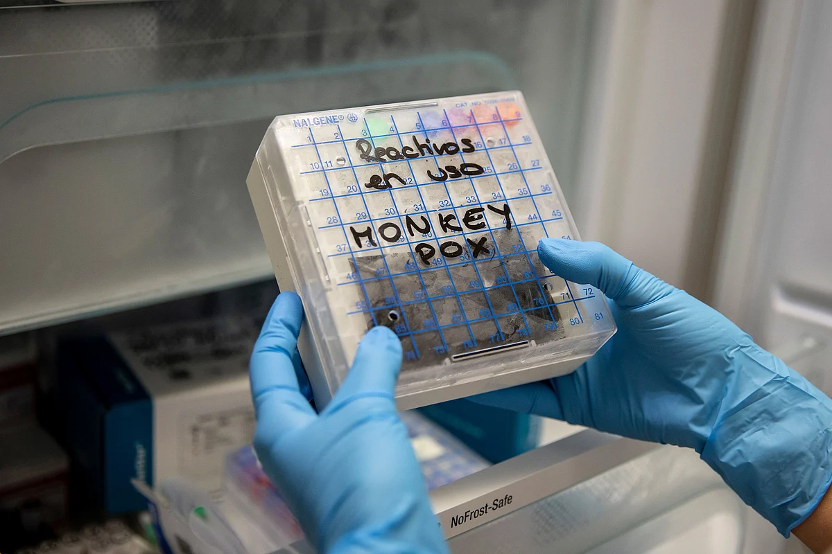 <div class="paragraphs"><p>A medical technician picks up a reactive to test suspected monkeypox samples in Spain. (Photo by Pablo Blazquez Dominguez/Getty Images)</p></div>