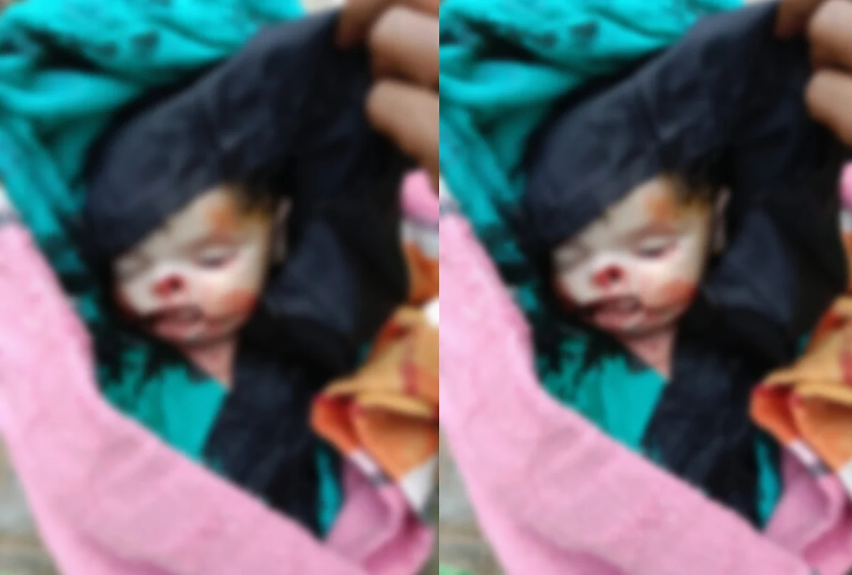 Viral News: डिलीवरी रूम में भर्ती बच्चे का मुंह खा गया जानवर, अस्पताल में बड़ी लापरवाही