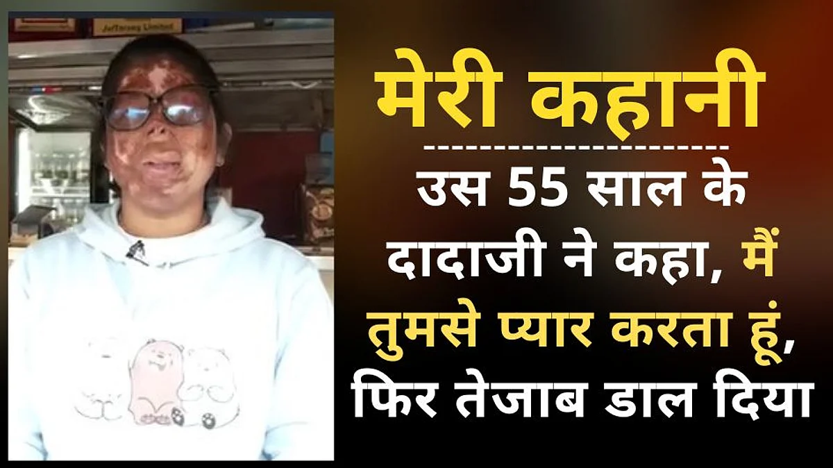 Acid Attack Survivor Anshu Story