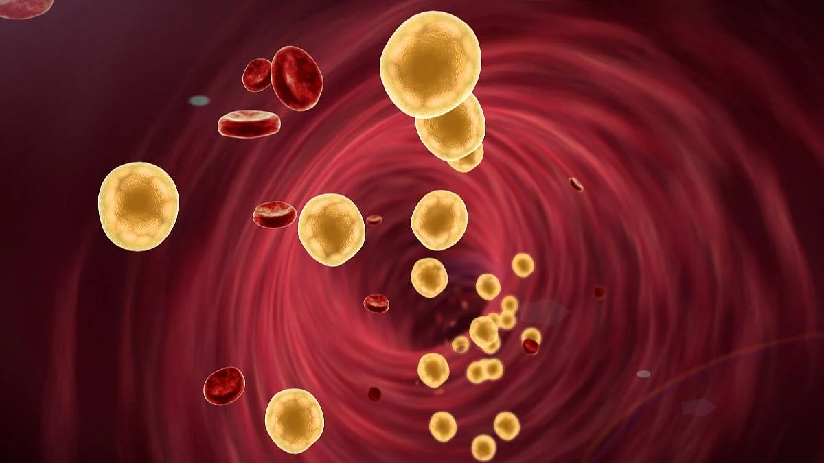 Cholesterol Control Tips