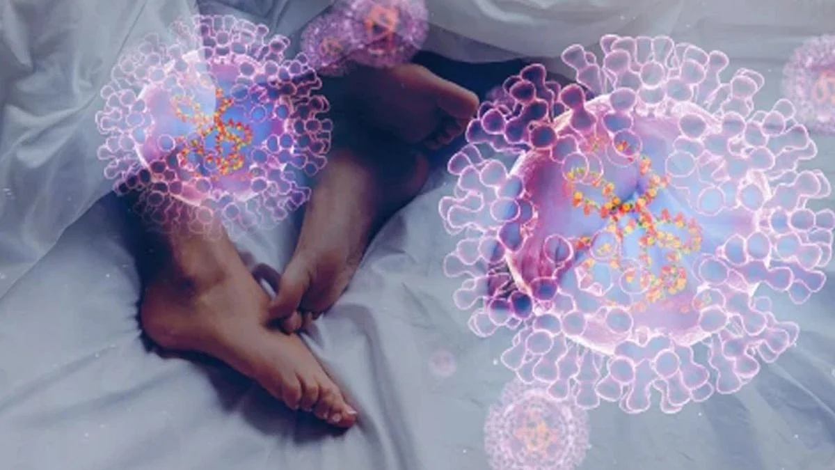 Monkeypox: सेक्स'मधून व्हायरसचं होतयं संक्रमण? तज्ञांचा इशारा
