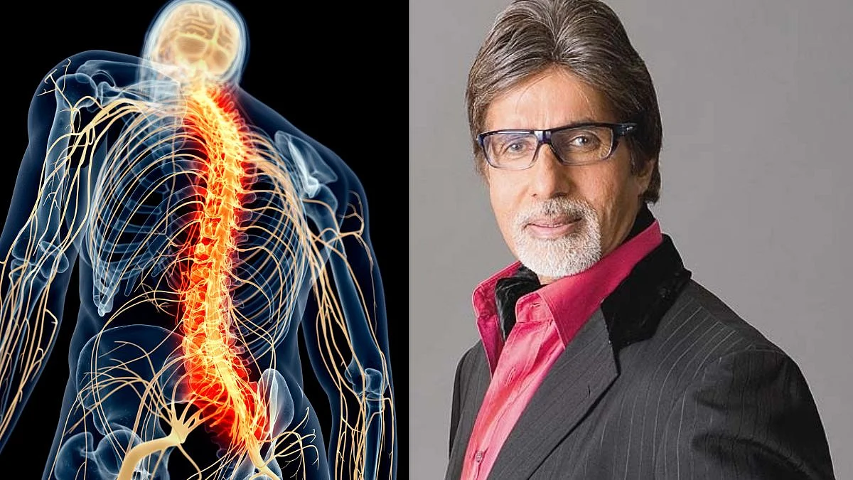 Big B was suffering from spinal TB