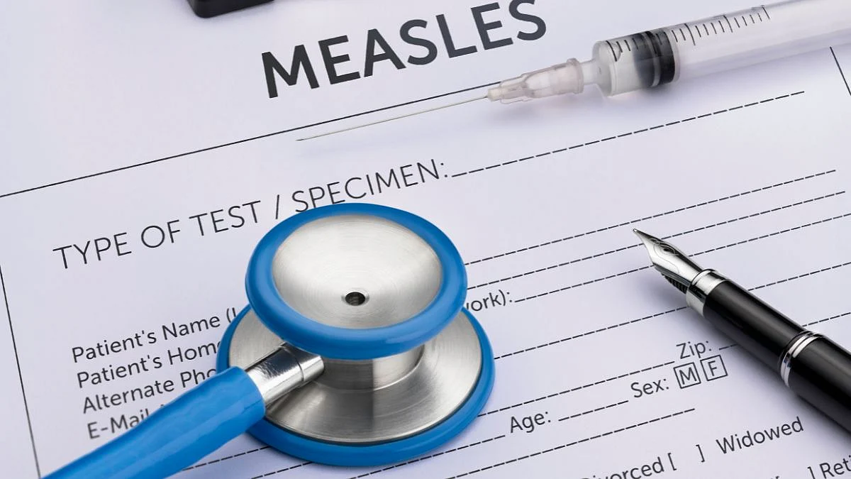 Measles Causes