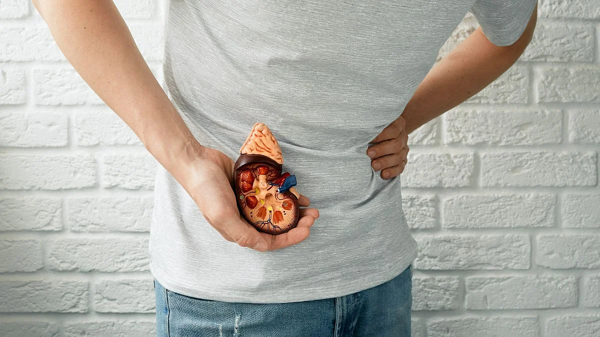 Kidney Stone Symptoms