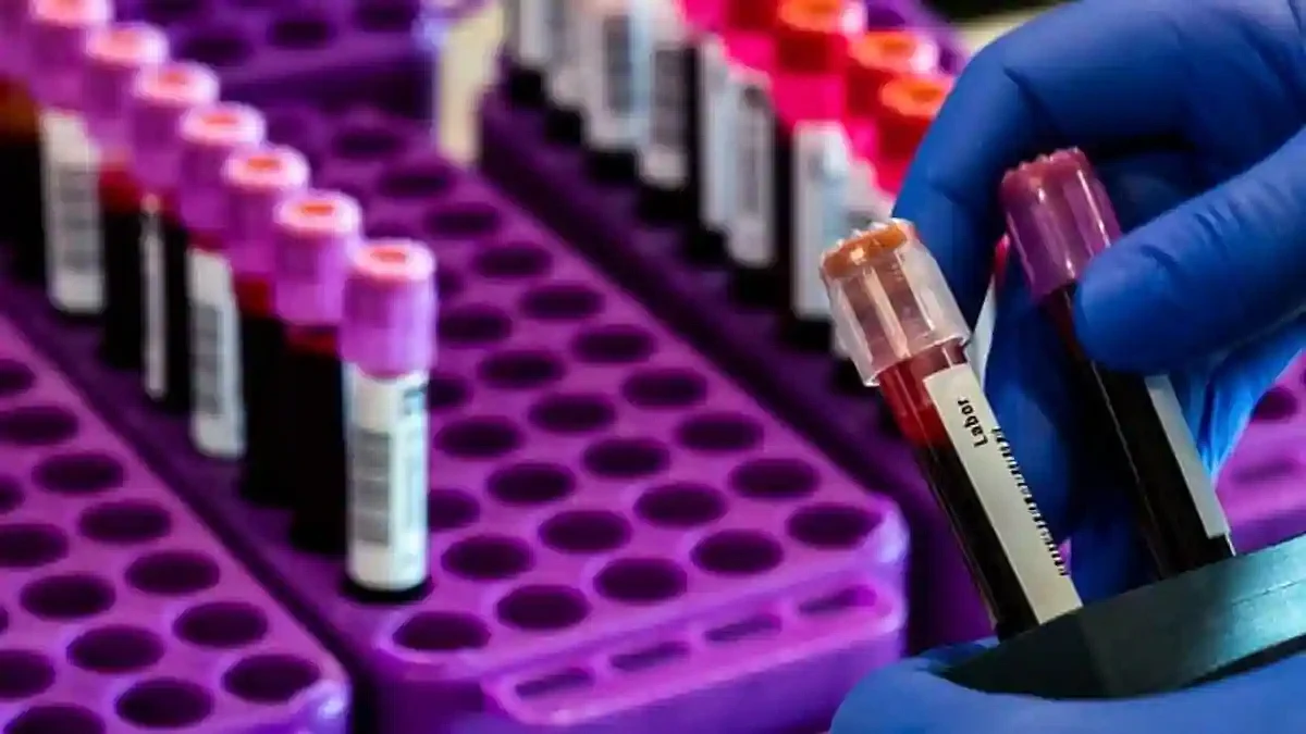 Coronavirus : जिल्ह्यात 30 मृत्यू, 3229 रूग्ण वाढले