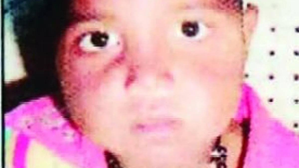 मोटरसायकलच्या धडकेत जखमी झालेली बालिका तीन दिवसांपासून बेपत्ताच