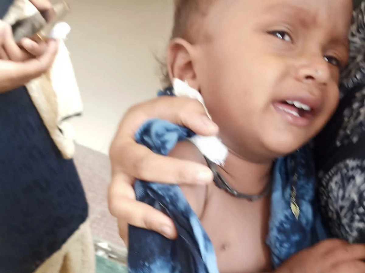 कुत्र्याने दीड वर्षाच्या मुलाचे तोडले लचके