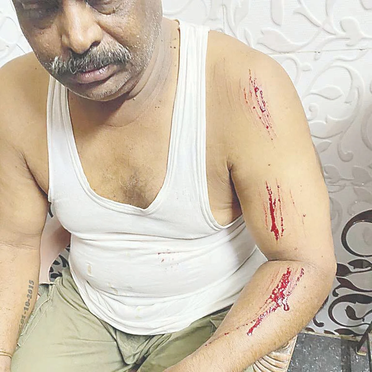One injured in leopard attack at Igatpuri