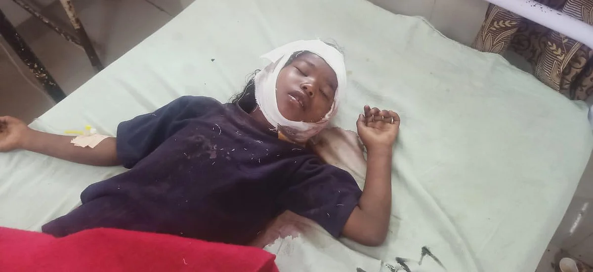 Leopard attacks girl in Trimbakeshwar