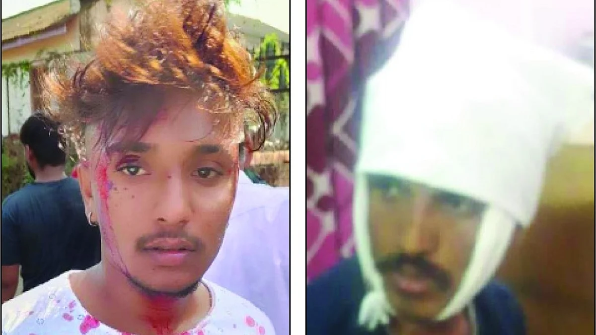 भालोदला बौद्ध वस्तीवर हल्ला, दोघे गंभीर जखमी