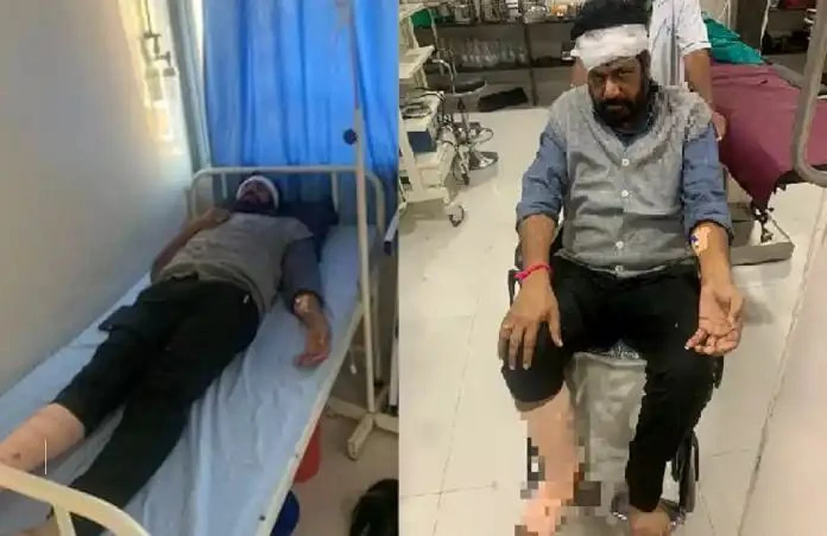 आमदार बच्चू कडू यांचा अपघात; डोक्याला मार, पायाला दुखापत