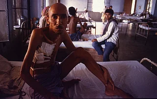India continues to have the highest number of TB cases in the world. Credit: Pradip Saha / CSE