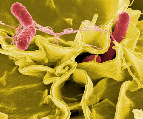 Salmonella Credit: Wikimedia Commons
