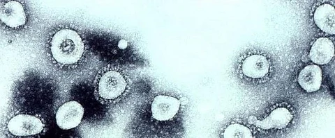 Second case of Coronavirus confirmed in the US