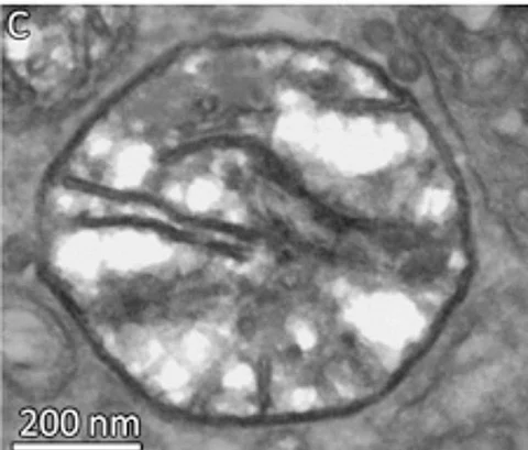 Scientists accidentally discover parasite that doesn't breathe oxygen