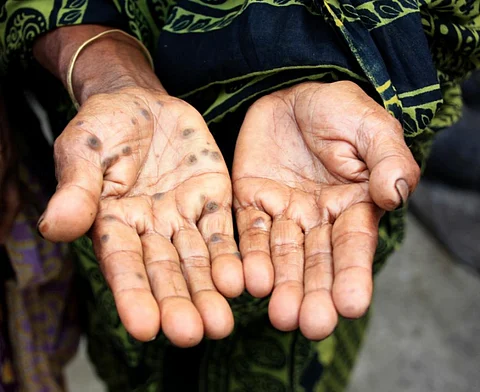 Arsenic-affected habitations in India up 145% in last 5 yrs