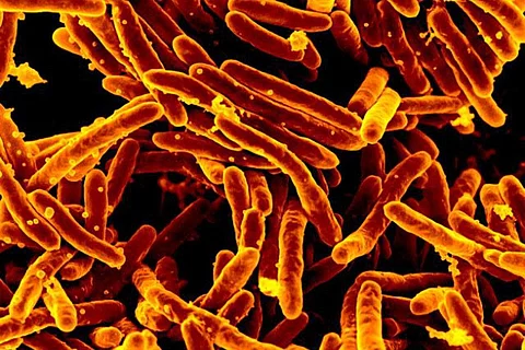 COVID-19 added over $290 billion to the global cost of TB deaths: Study
