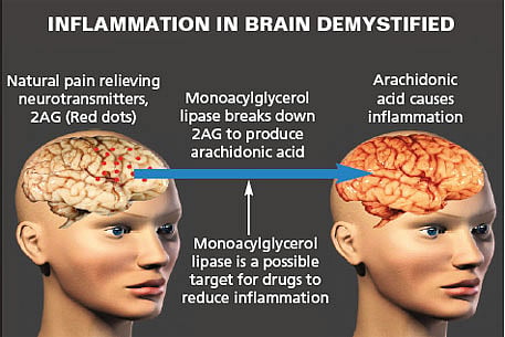 What Disease Causes Swelling Of The Brain - Infoupdate.org