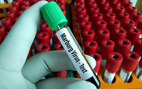 Rwanda declares end of Marburg outbreak: WHO Africa