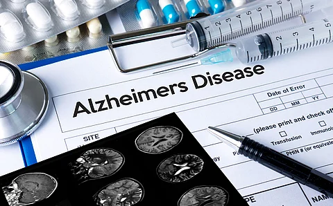 New study pinpoints potential target involved in stress response for treating Alzheimer’s disease