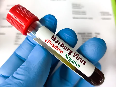 Suspected Marburg virus outbreak in Tanzania kills 8