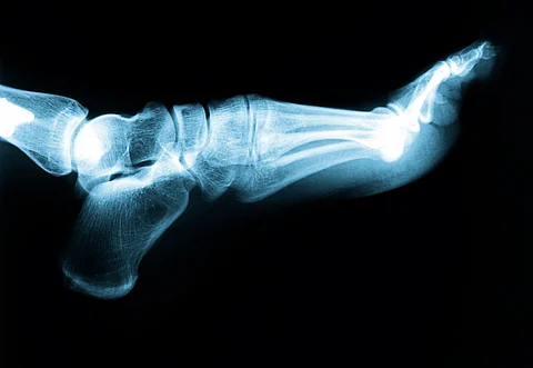 Diabetic foot pain: Expert tips on how to cope