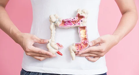 Colon cancer rates are rising among young people — could changes to children’s gut bacteria explain why?