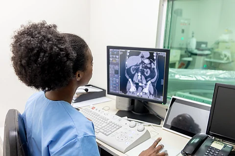 Chronic kidney disease with hypertension significant public health concern in sub-Saharan Africa