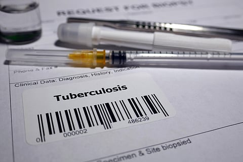 Tuberculosis elimination in India: With days left national plan target, are we any close?