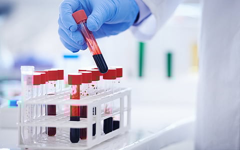 Your blood proteins could predict your risk of an early death