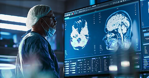 Huntington’s disease: Treatments are finally on the horizon after research breakthroughs