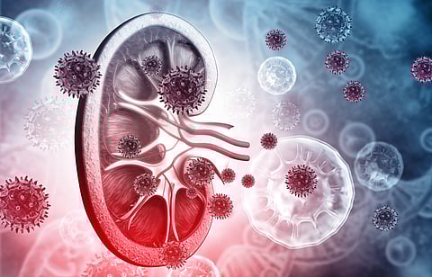 Kidney disease is growing in Africa: Big new study casts light on genetic risk factors