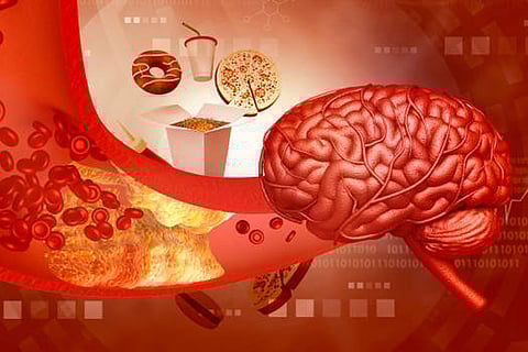 अल्ट्रा-प्रोसेस्ड खाद्य पदार्थ भूख, संतुष्टि और आत्म-नियंत्रण से जुड़े दिमागी हिस्सों को प्रभावित कर सकते हैं।