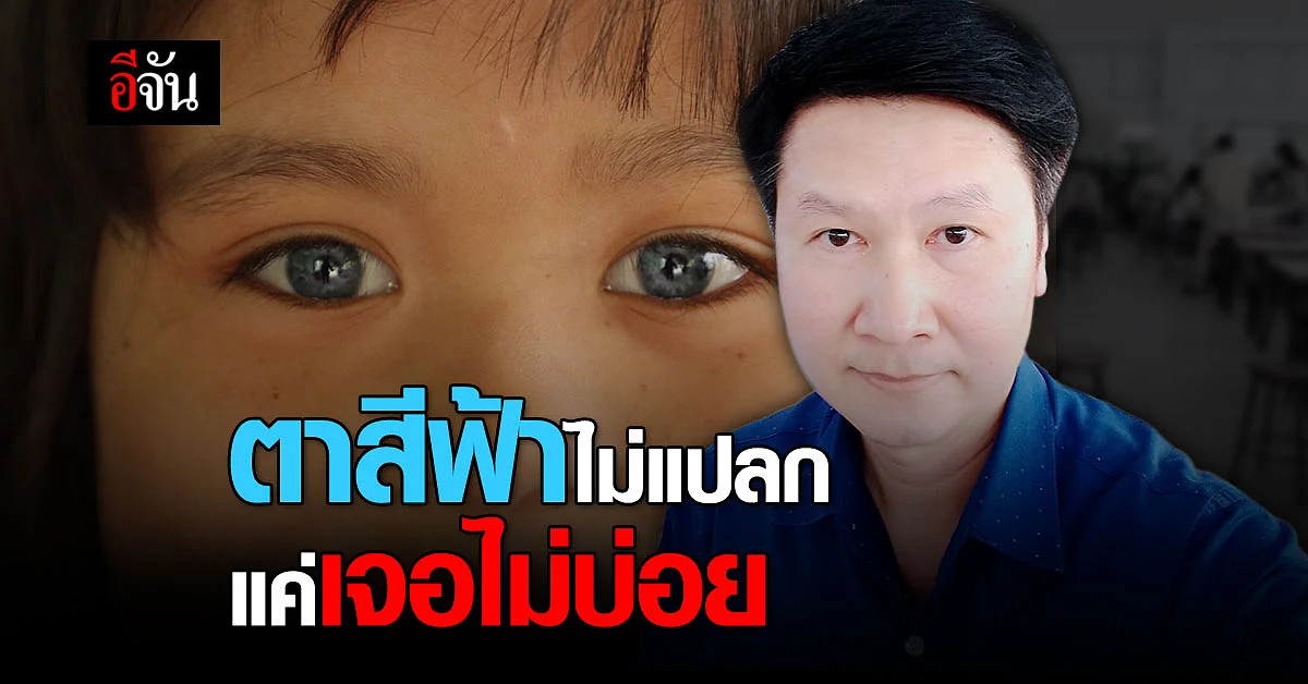 หนูน้อย ตาฟ้า อ.เจษฎา ชี้ ไม่ใช่เรื่องแปลก แค่เจอไม่บ่อย