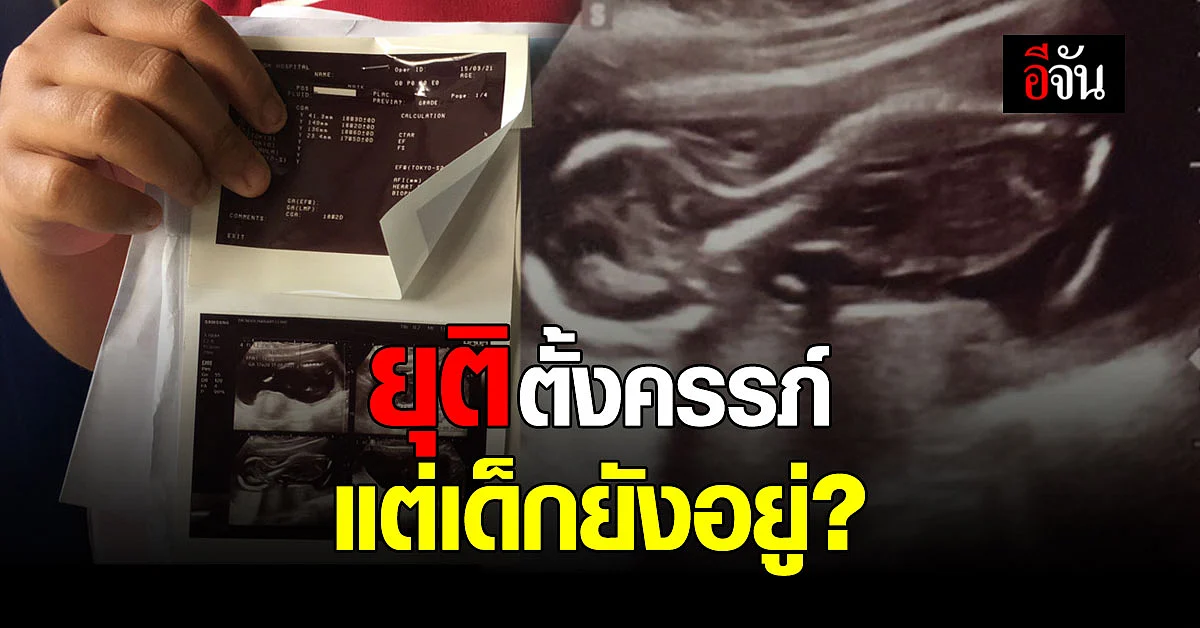 สาว 19 สุดงง! ครรภ์เป็นพิษ ยุติการตั้งครรภ์ไปแล้ว แต่เด็กยังโตในท้อง