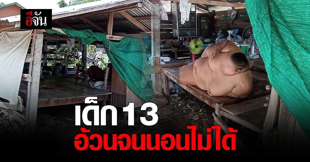 สุดรันทด…เด็กวัย 13 อ้วนหนัก 200 กก. นอนไม่ได้ ญาติวอนพาไปรักษา